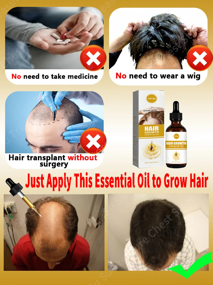 Fast Hair Growth - My Store