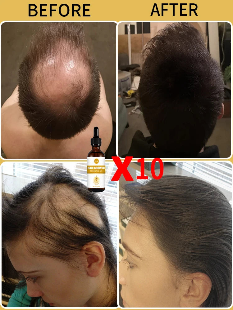 Fast Hair Growth - My Store
