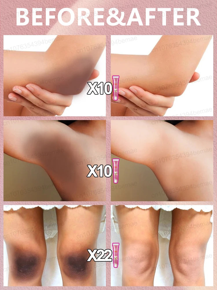 Whitening Cream