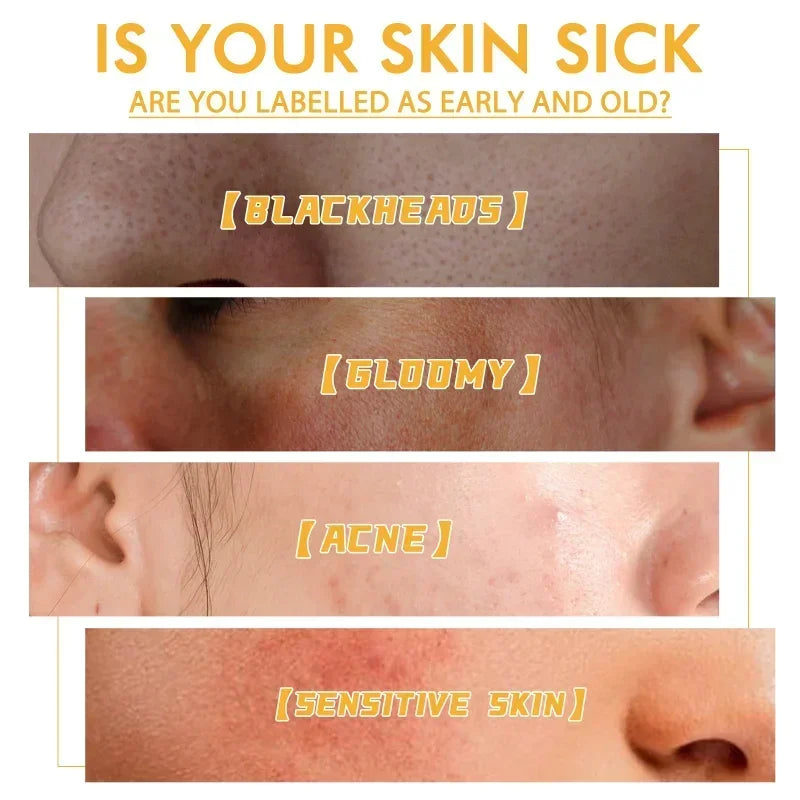 Deep Clean Pores Face Skin Care