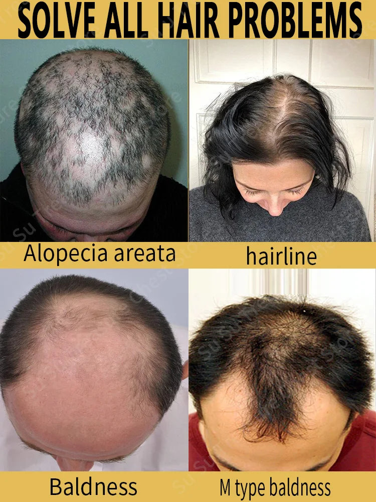 Fast Hair Growth - My Store
