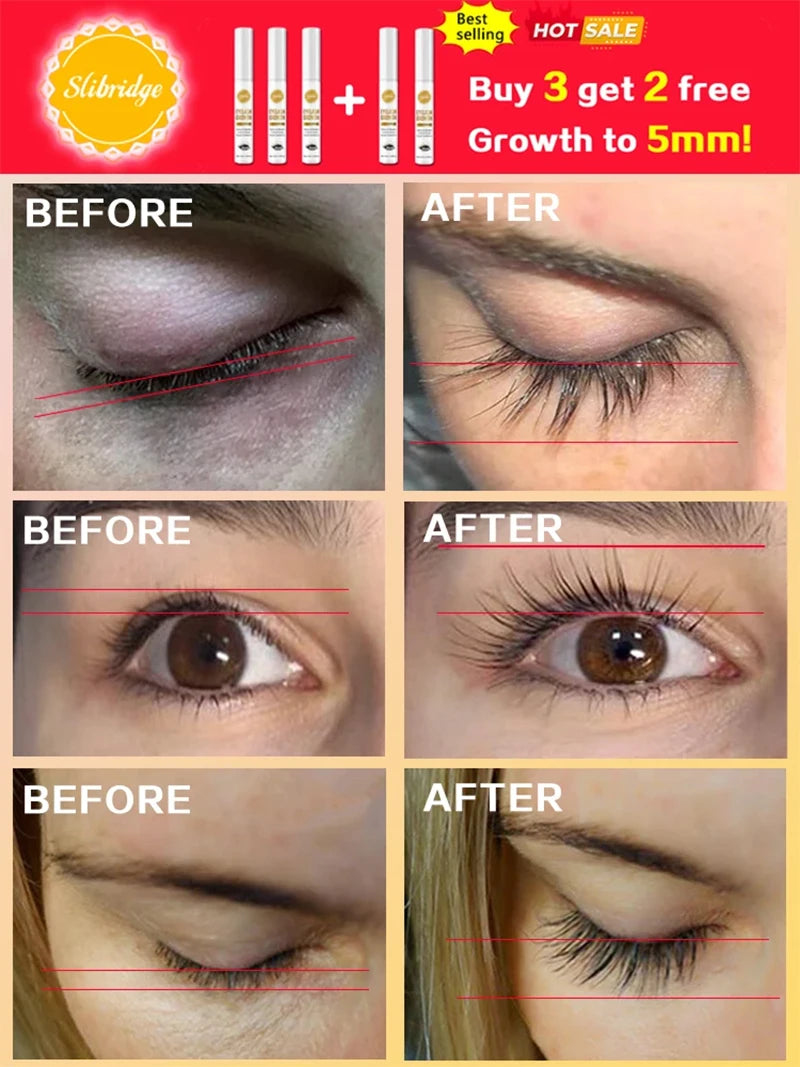 Natural Eyelash Growth - My Store