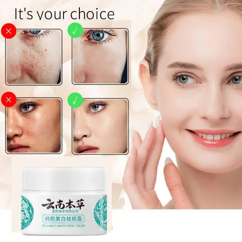 Yunnan Herbal Whitening Freckle Removal Cream