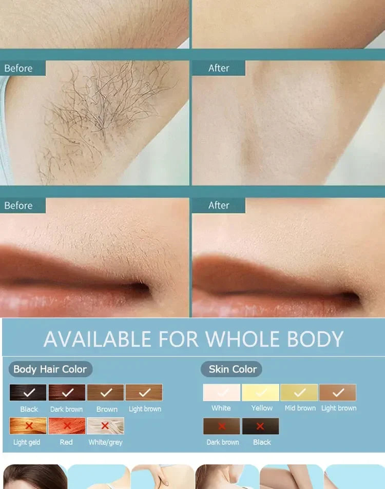 Laser Epilator IPL Hair Removal For Women Body Bikini Facial Permanant Painless IPL Hair Remover Laser Epilator