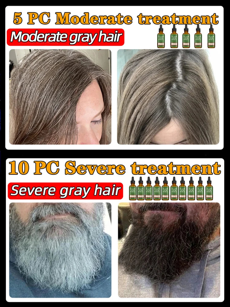 Anti Gray Hair Serum Remedy