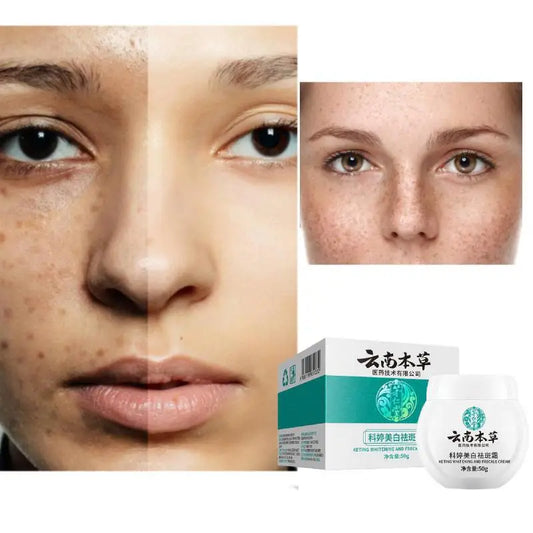 Yunnan Herbal Whitening Freckle Removal Cream