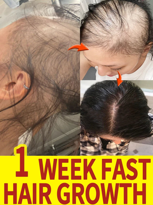 Fast Hair Growth - My Store