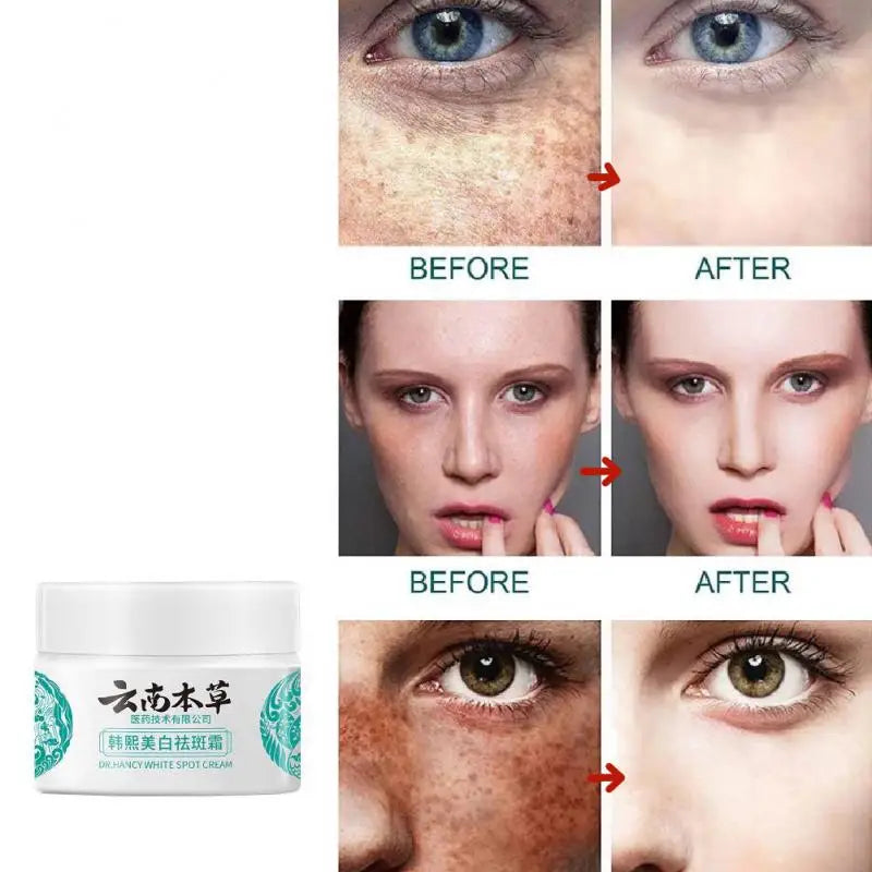 Yunnan Herbal Whitening Freckle Removal Cream