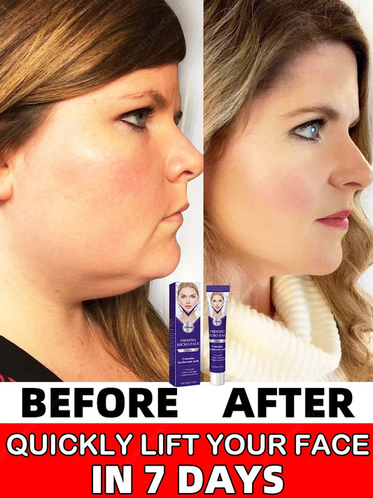 Face Slimming Cream - My Store